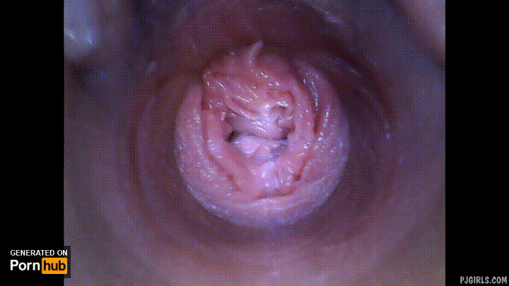 Inside Vagina Photo